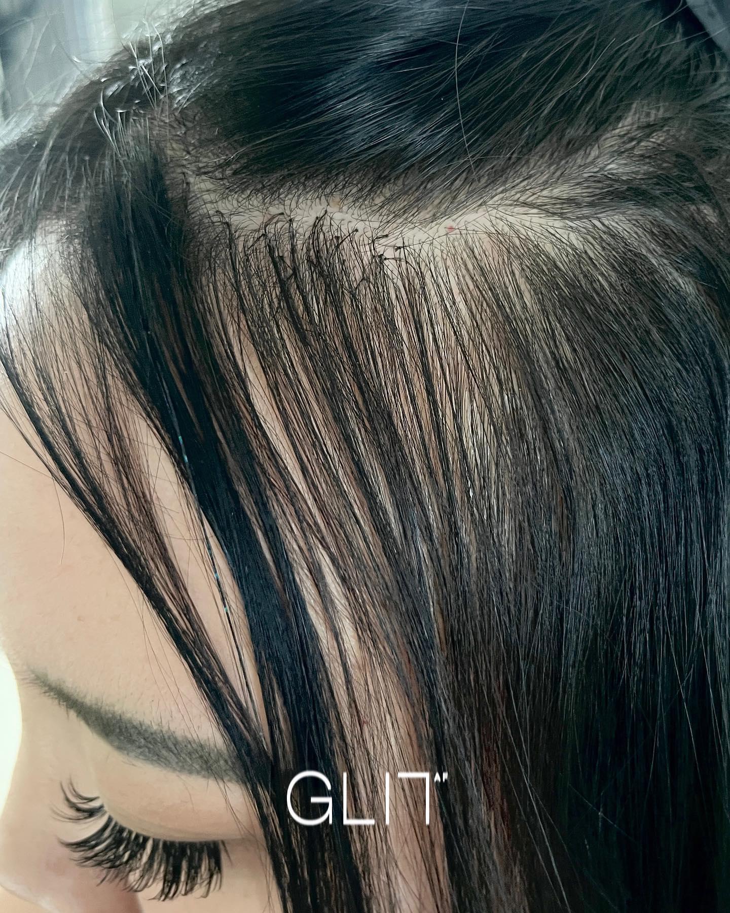 Glit AF — photo 8