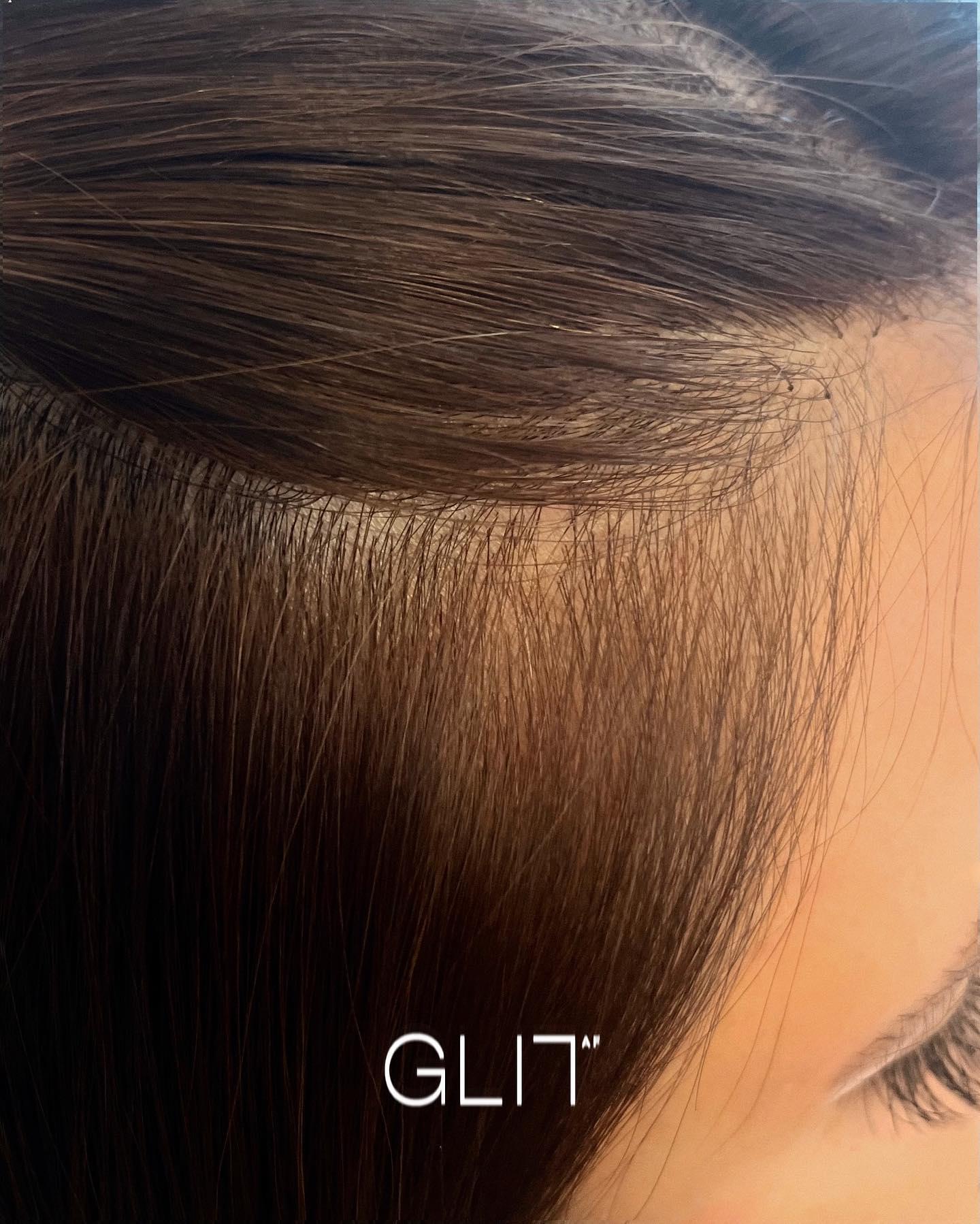 Glit AF — photo 9