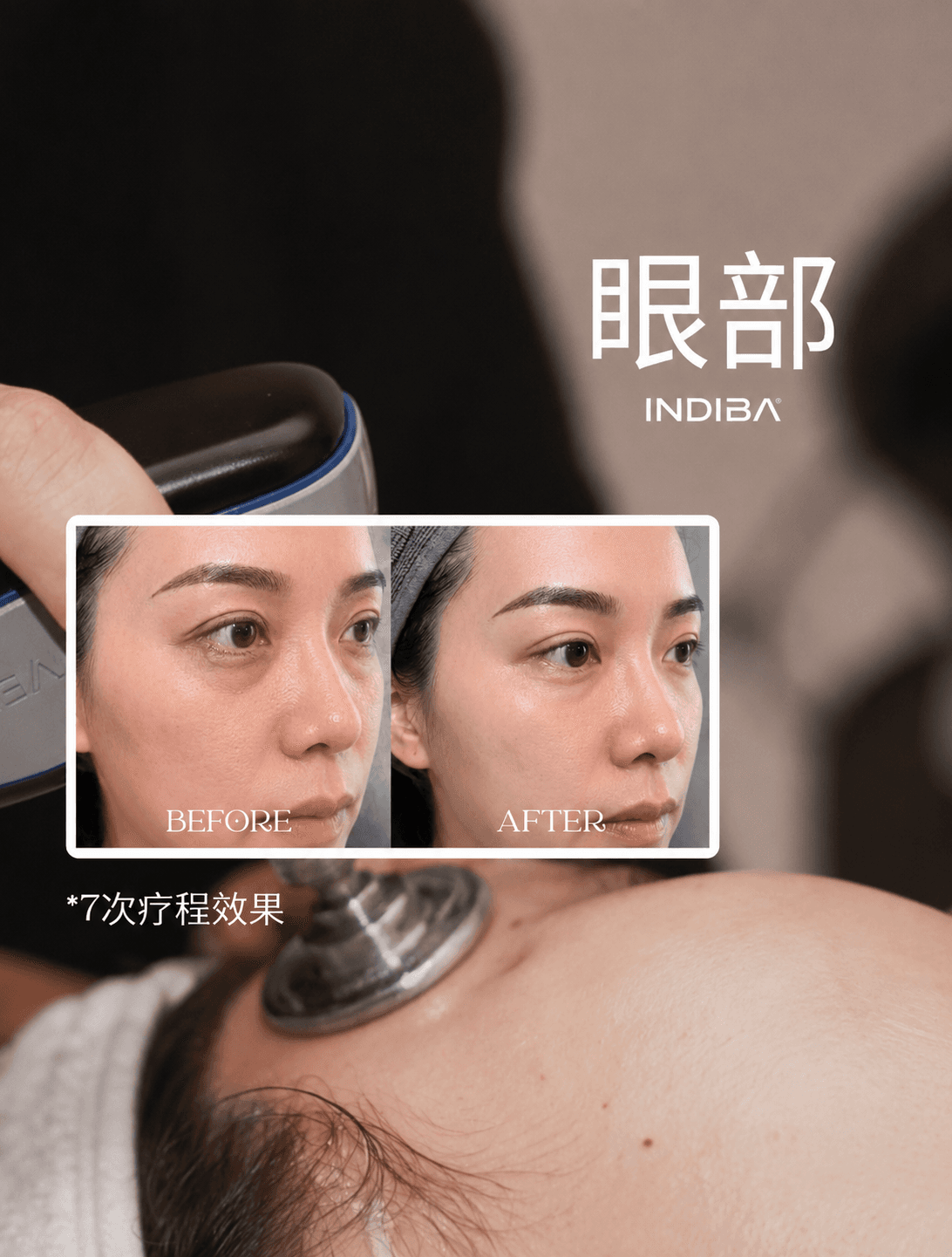 Minako Beauty Skin and Wellness — photo 6