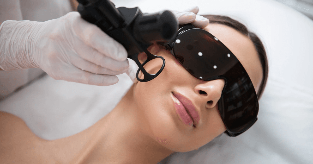Fractional CO2 Laser, 5+2 Sessions + FREE Aloe Gel