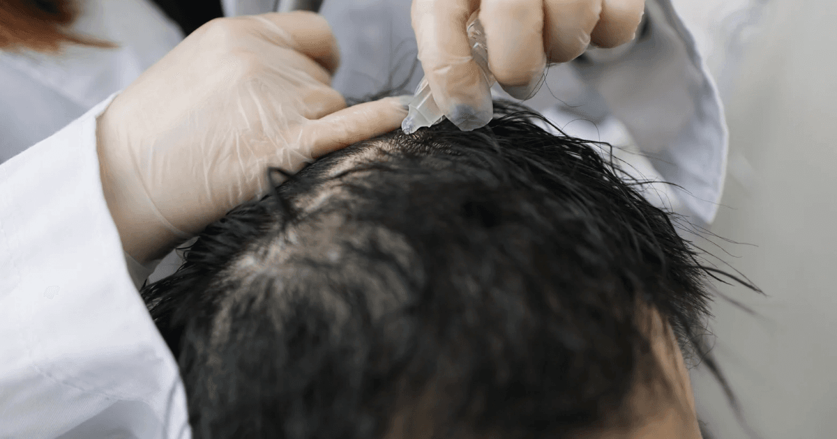 Hair Regrowth Stem Cell + Booster + FREE Lotion