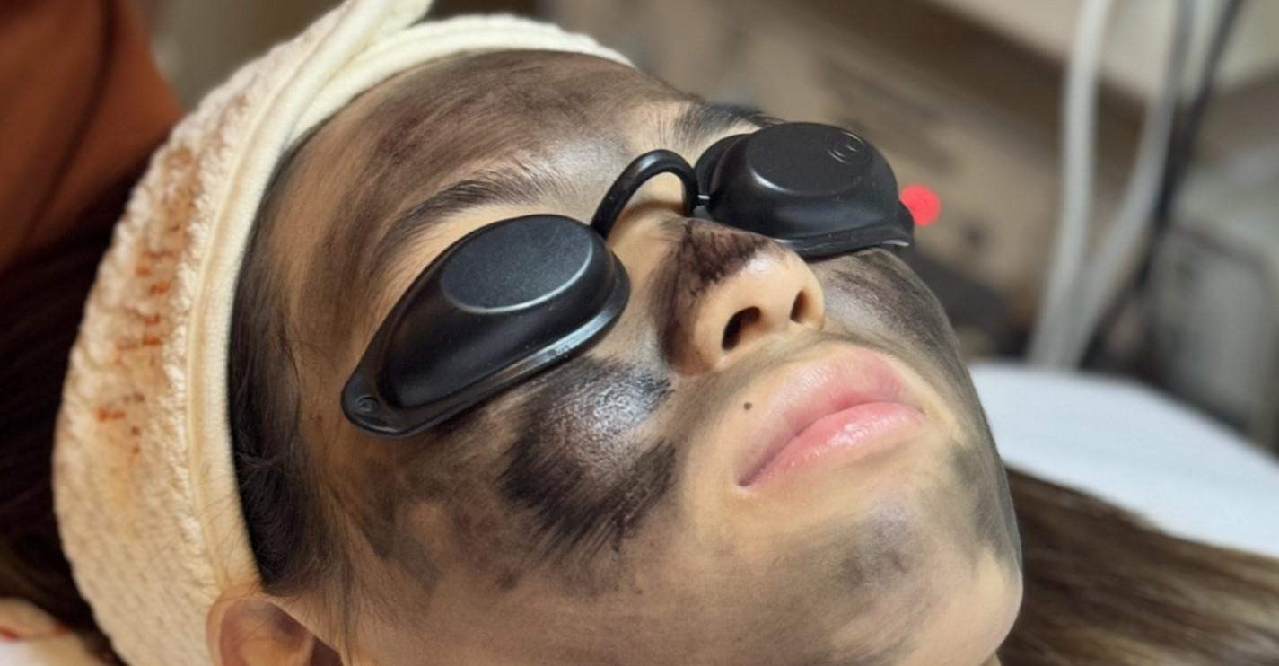 Carbon Laser Peel + Pure Light Plasma Facial