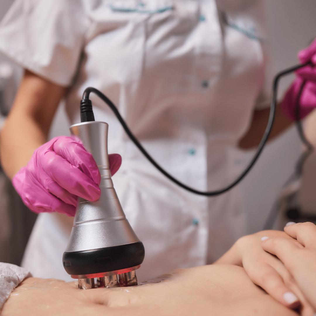 RF Body Tightening: Unlimited for 3 Months, 3 Areas