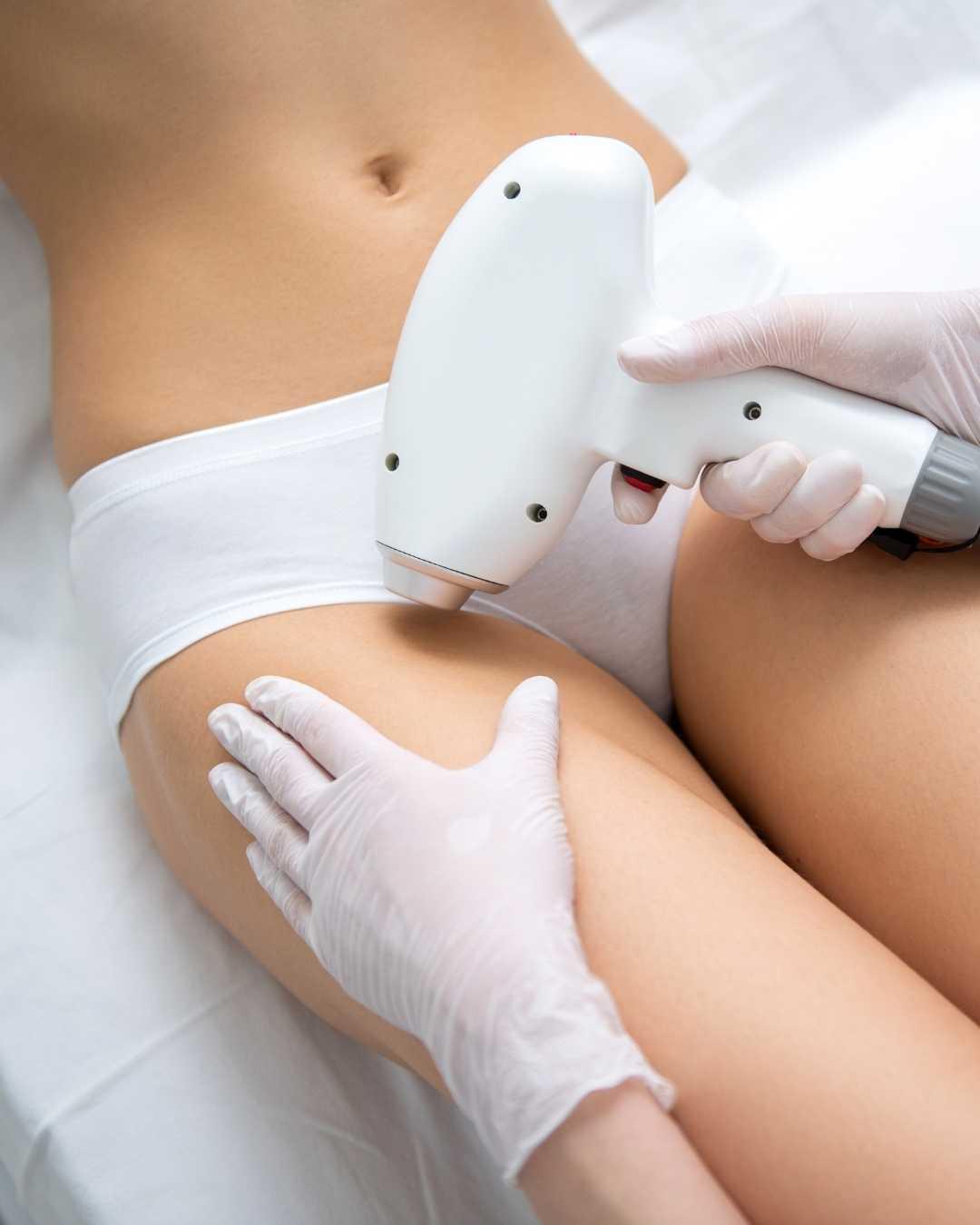 Diode Laser Hair Removal, Bikini Area with Puresilk